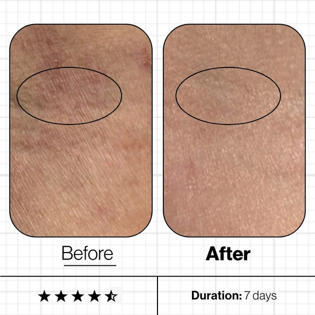 Skin Moisture IQ (NEW & IMPROVED)